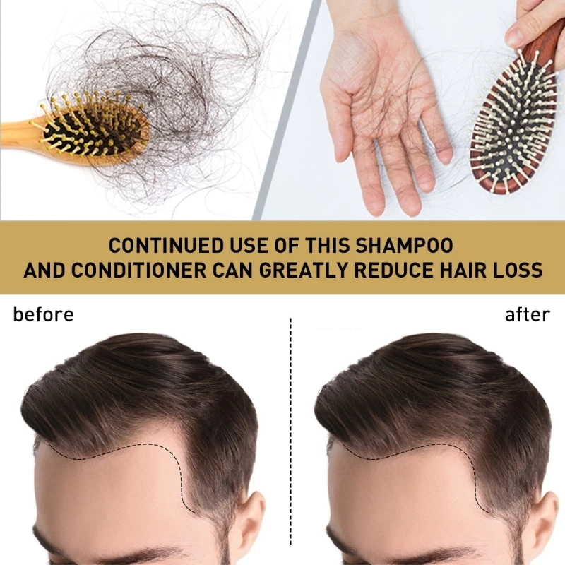 Имбирный шампунь Против выпадения волос, Облысения, Перхоти, Эффективный Питательный Увлажняющий Шампунь для роста густых волос 5