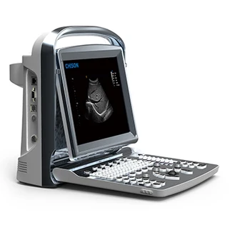 Медицинские ультразвуковые инструменты, портативный ультразвуковой доплеровский аппарат ECO1, ультразвуковой сканер Chison, цена для использования человеком