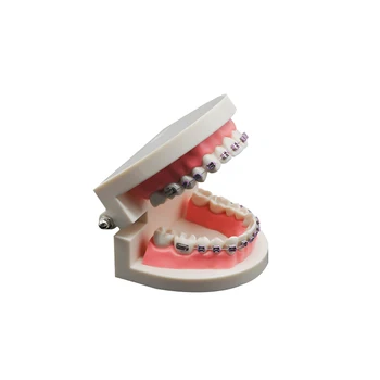 обучающая модель для ортодонтического лечения зубов, 1 шт., с орто-металлическим кронштейном, дугообразной проволочной буккальной трубкой, лигатурными стяжками