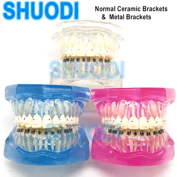 Цельнолитая стоматологическая ортодонтическая прозрачная модель зубов с обычными керамическими и металлическими брекетами и наборами для общения с пациентом